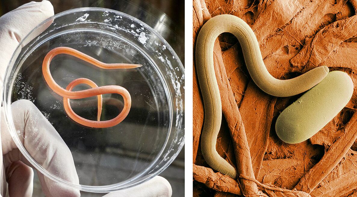 parasiidid inimkehas