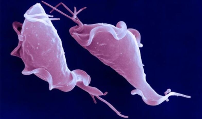 Trichomonas vaginalis on algloomade parasiit, mis põhjustab viljatust.